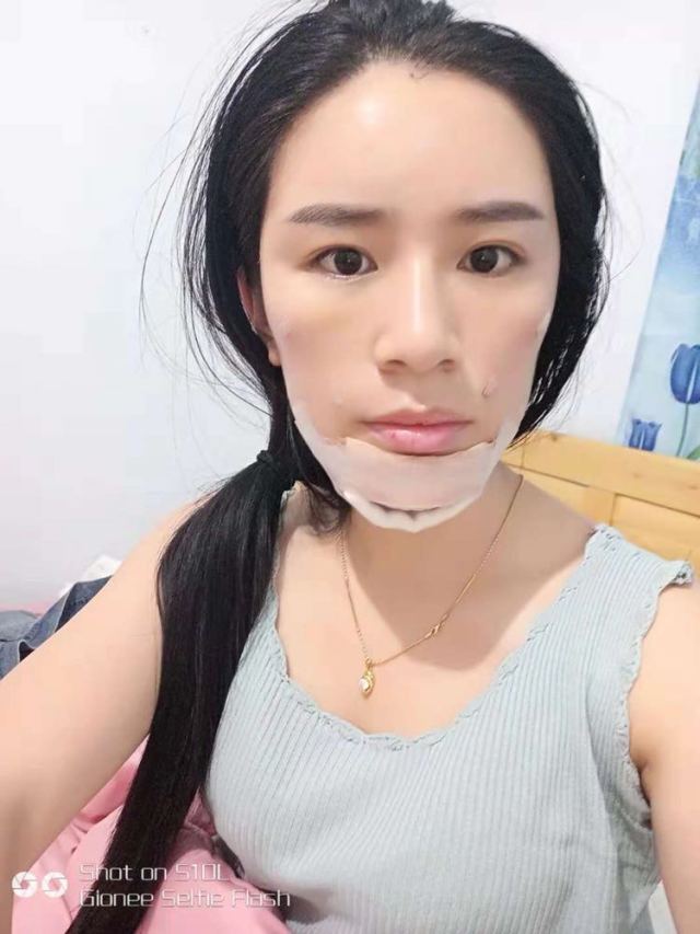 成都臻瑞医疗的整形术后图片