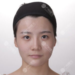 整形前后对比图片