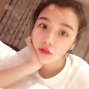 整形前后对比图片