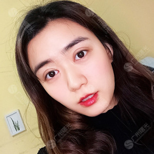 整形前后对比图片