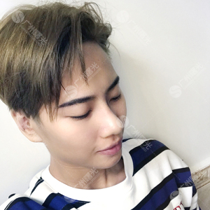 整形前后对比图片