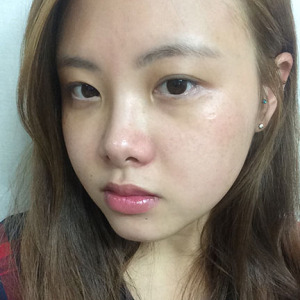 整形前后对比图片