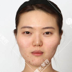 整形前后对比图片