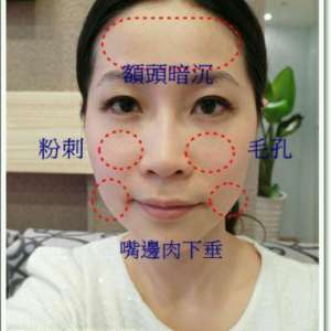 整形前后对比图片