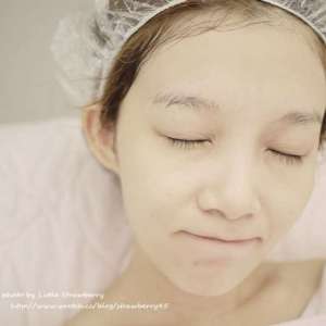 整形前后对比图片