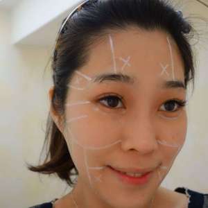 整形前后对比图片