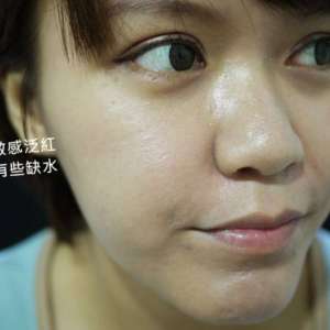 整形前后对比图片