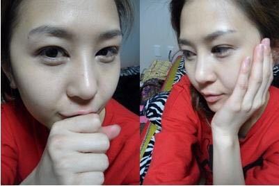 整形前后对比图片