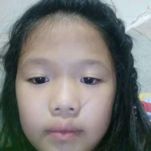 整形前后对比图片