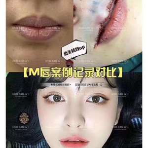 整形前后对比图片