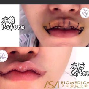 整形前后对比图片