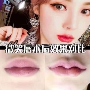 整形前后对比图片