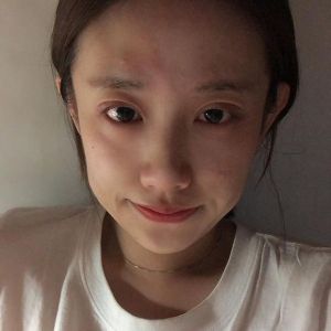 整形前后对比图片