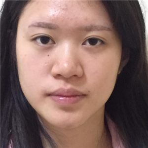 整形前后对比图片