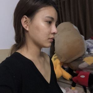 整形前后对比图片