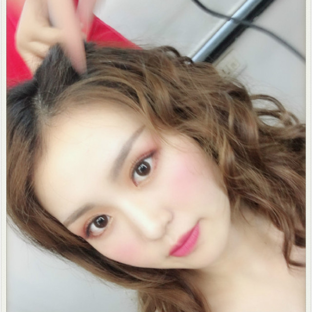 离别怎么有泪呢的整形术后图片