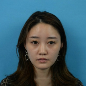 整形前后对比图片