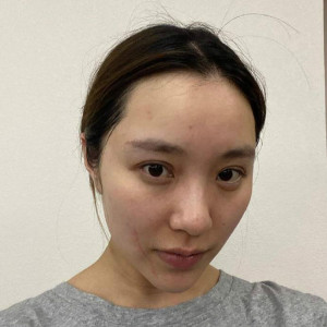 整形前后对比图片