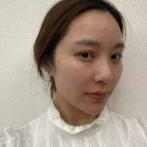 整形前后对比图片