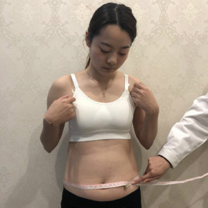 整形前后对比图片