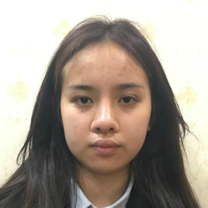 整形前后对比图片