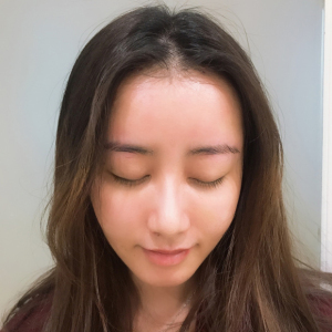 杨明露的整形术后图片