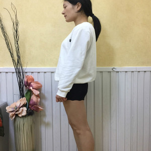 整形前后对比图片