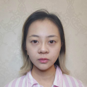 整形前后对比图片