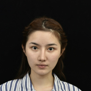 整形前后对比图片