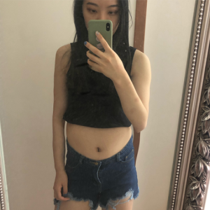 整形前后对比图片