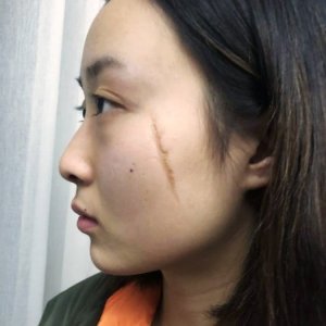 整形前后对比图片