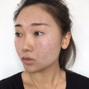 整形前后对比图片