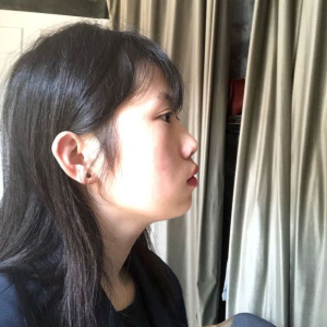 整形前后对比图片