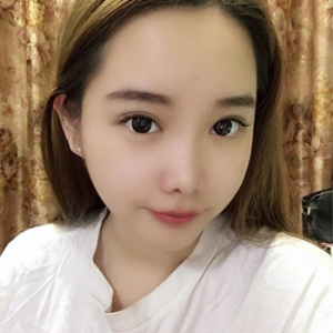 于之瑶的整形术后图片