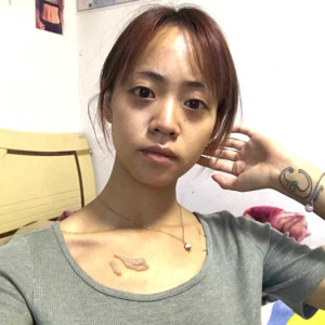 整形前后对比图片