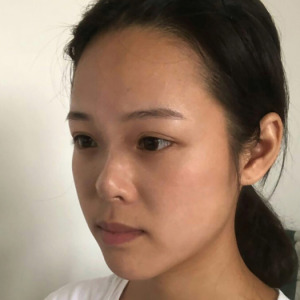 整形前后对比图片