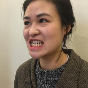 整形前后对比图片