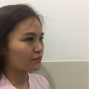 整形前后对比图片