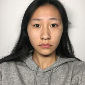 整形前后对比图片