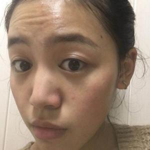 整形前后对比图片