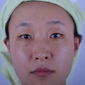 整形前后对比图片