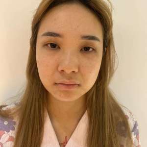 成都春菲乐医疗美容医院的日记