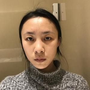 整形前后对比图片