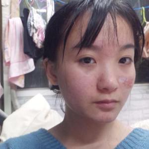 整形前后对比图片