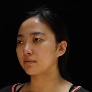 整形前后对比图片