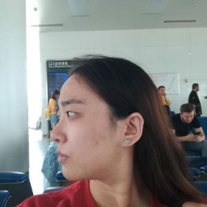 整形前后对比图片