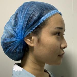 整形前后对比图片