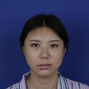 整形前后对比图片