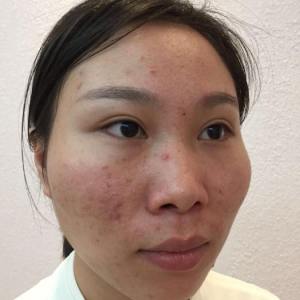 整形前后对比图片