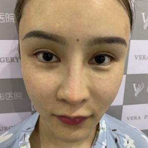 整形前后对比图片